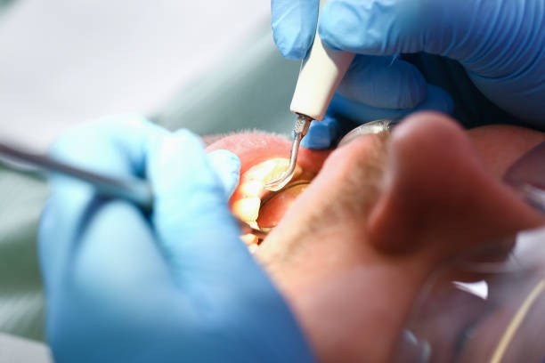 Best Emergency Dental Services for Seniors in Dillsboro, IN